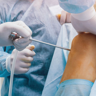 arthroscopy sports medicine 