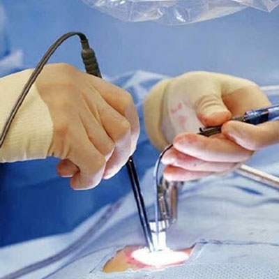 minimally invasive keyhole spine surgery