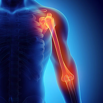 shoulder elbow surgery 