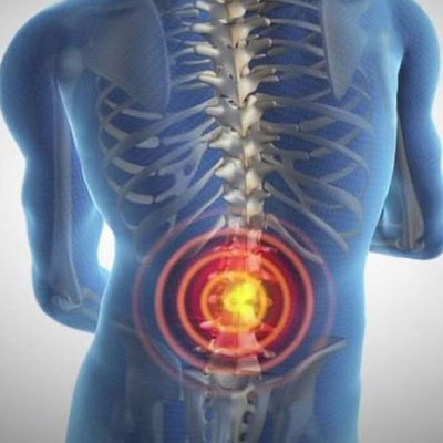 spinal tumor surgery 